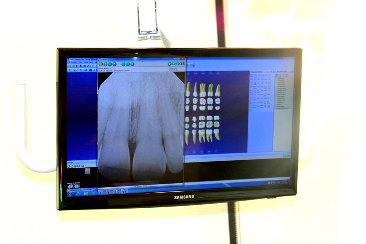 Digital x-ray displayed on chairside monitor